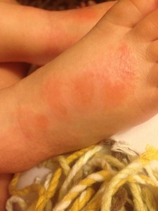 Raw feet