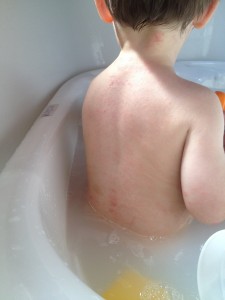 His back felt like a reptile. It broke my heart.