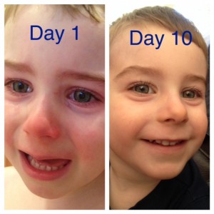 It's hard to see but he had dry patches near his tear ducts.